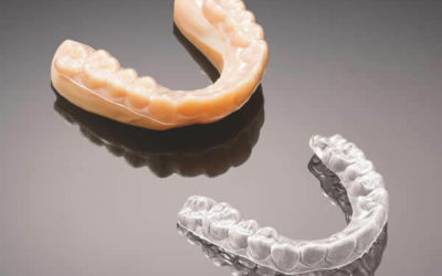 Le milieu dentaire : Plâtre pour empreinte dentaire ou moule par impression 3D ?